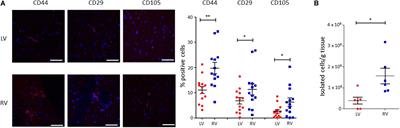 Human Cardiac Mesenchymal Stromal Cells From Right and Left Ventricles Display Differences in Number, Function, and Transcriptomic Profile